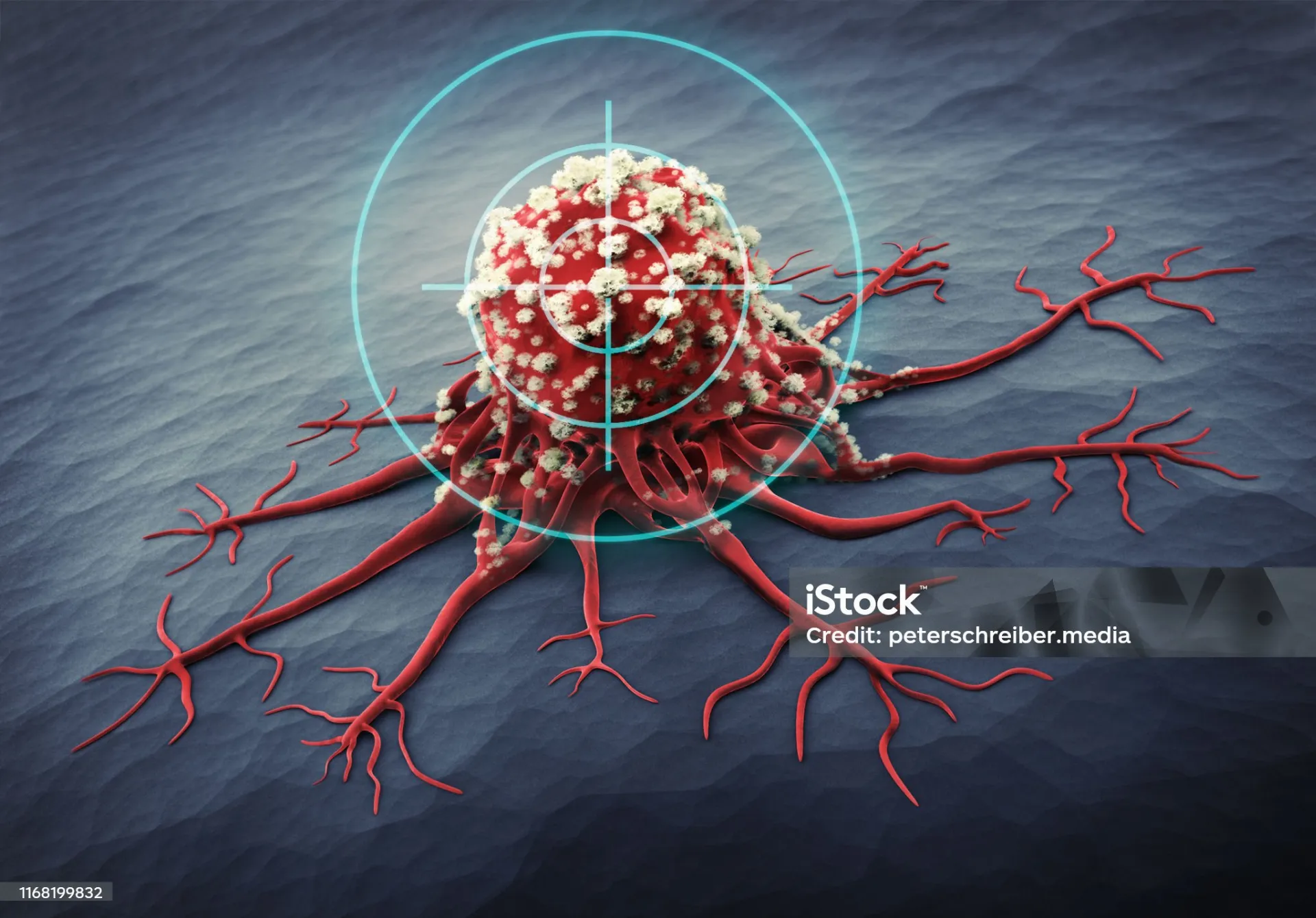 Impact of Azoospermia on Quality of Life: Insights from a Multi-Centric Cross-Sectional Study